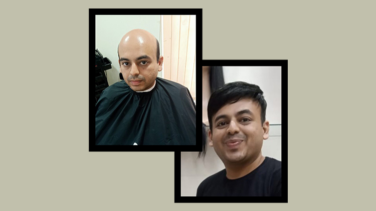 What is Non-Surgical Transplant, and how it works?