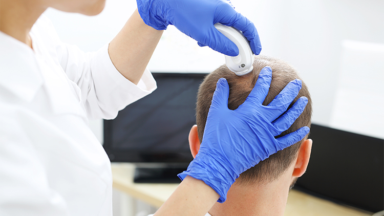 Why do people think that hair treatment for men is a good idea