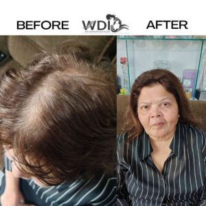 hair wigs for women