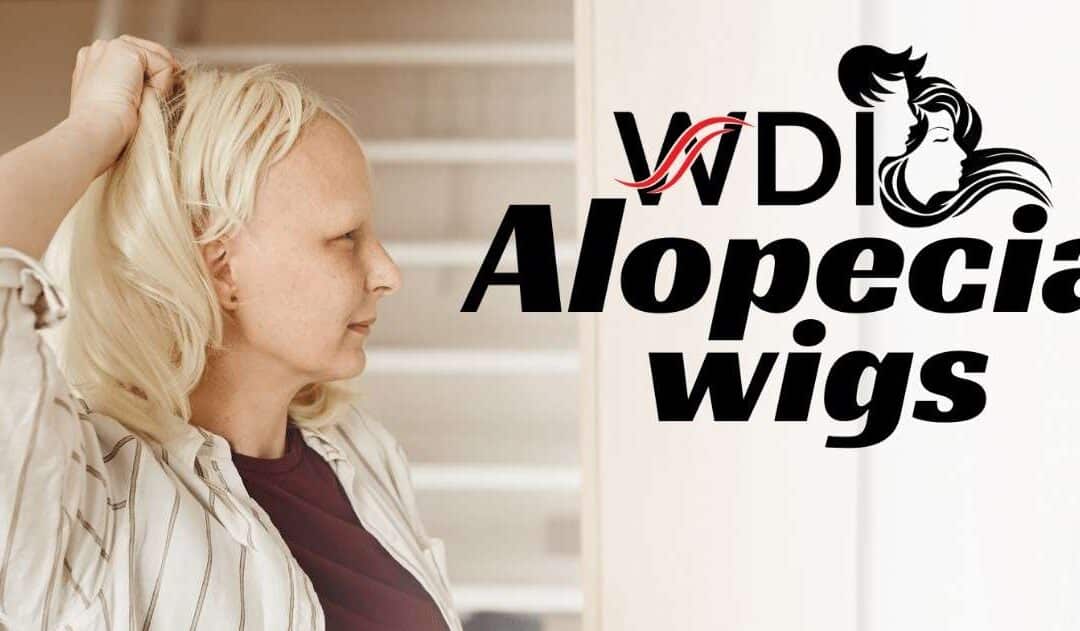 What Is Alopecia? Types, Causes & Treatment Options